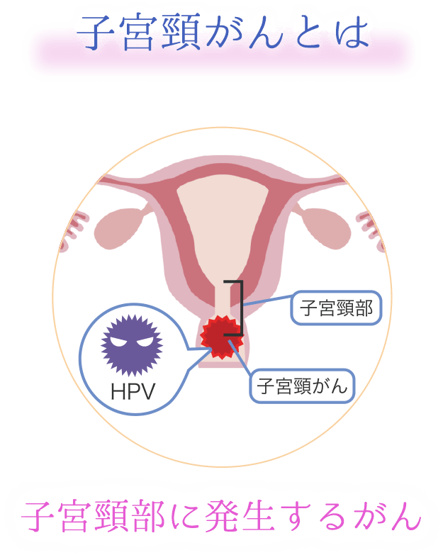 子宮頸がん検査セット PAPI’Qss（パピックス） 大丸松坂屋カード